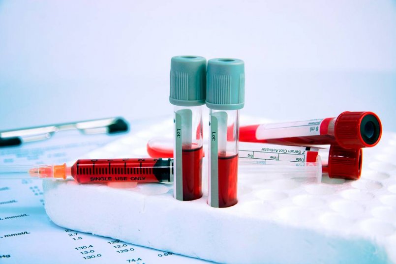 Цена анализа крови на гормоны в уфе thumbnail